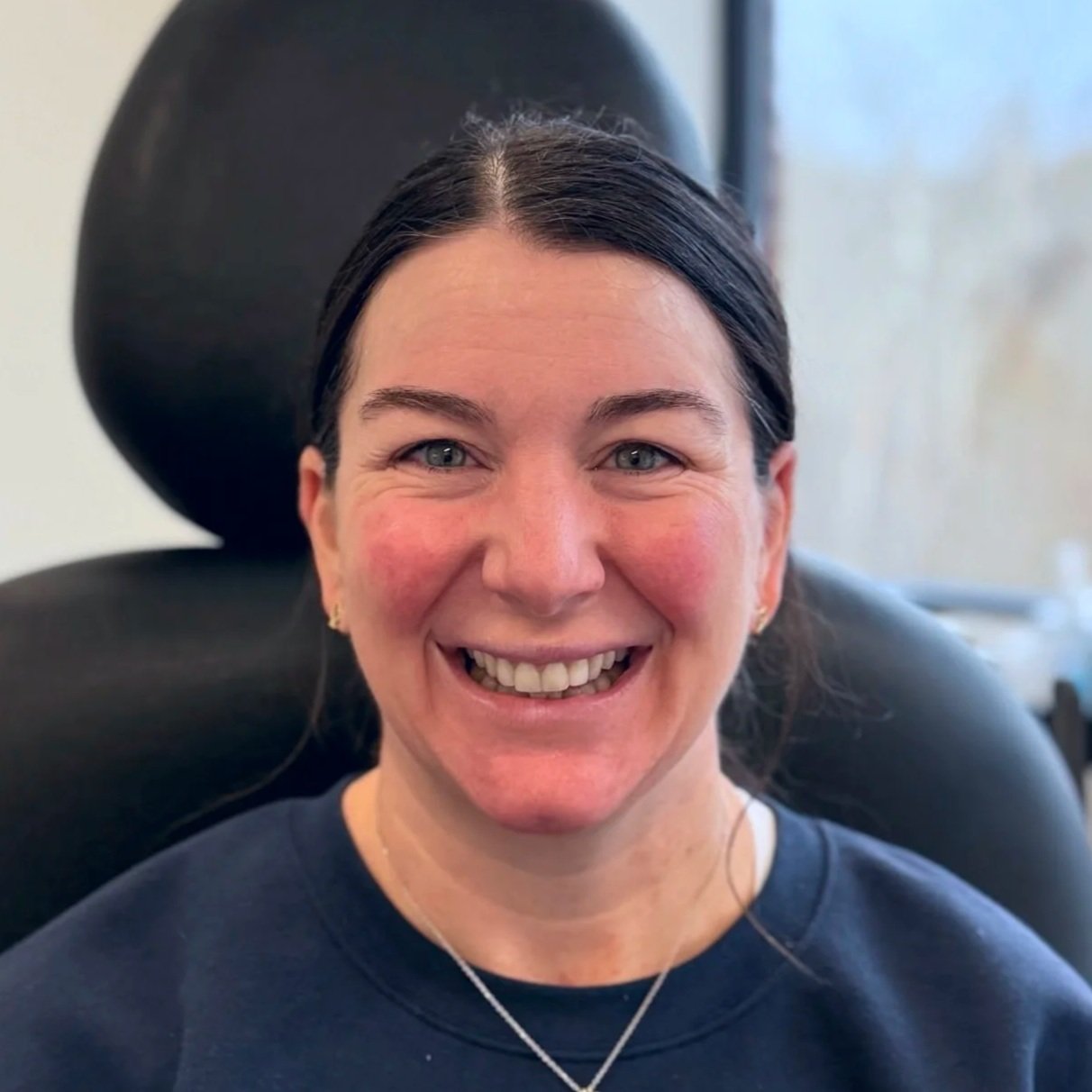 Female client before Neurotoxin treatment at Morph Med Spa in Ridgefield, CT – visible forehead, brow, and eye-area expression lines