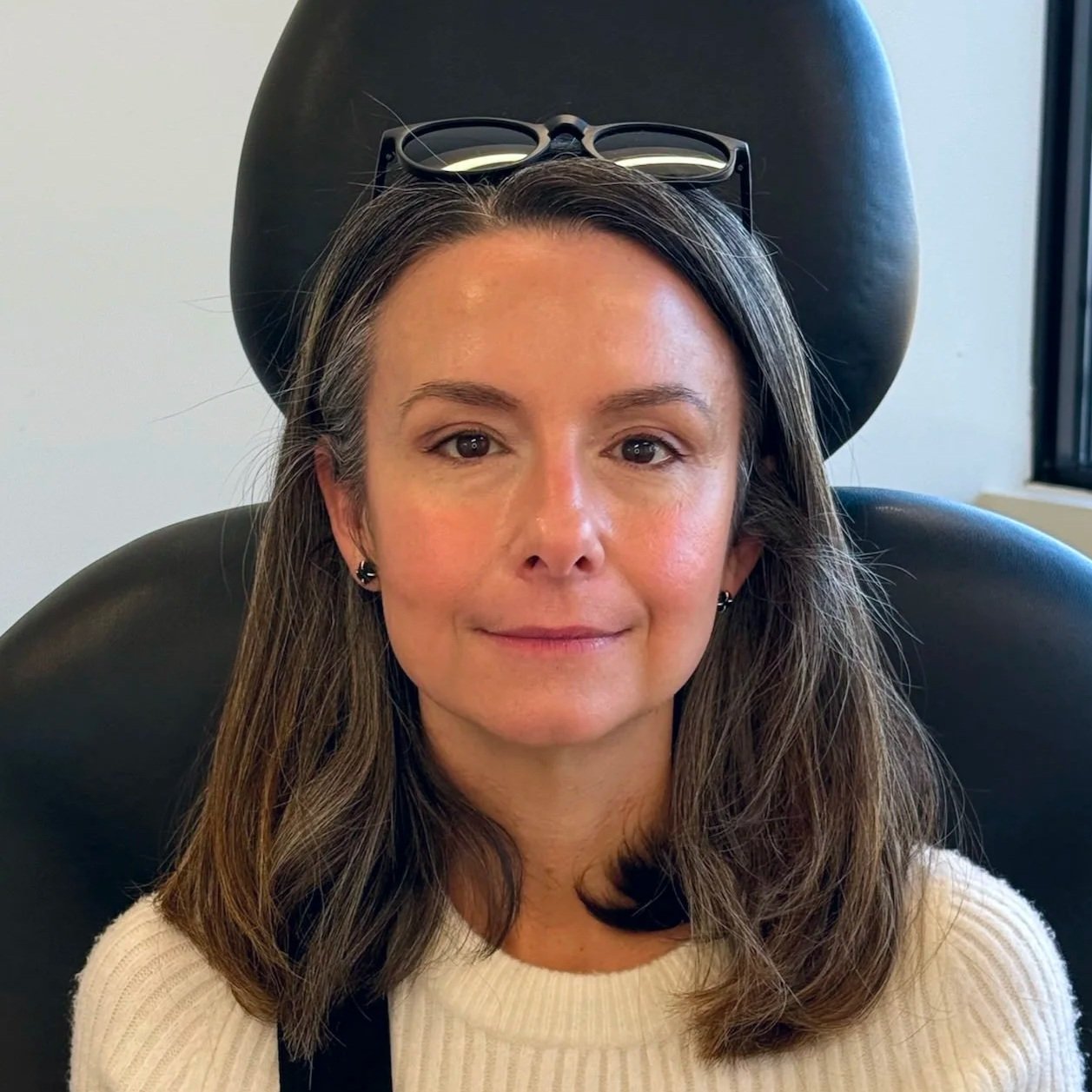 Female client after Neurotoxin treatment at Morph Med Spa in Ridgefield, CT — softened forehead and refreshed appearance