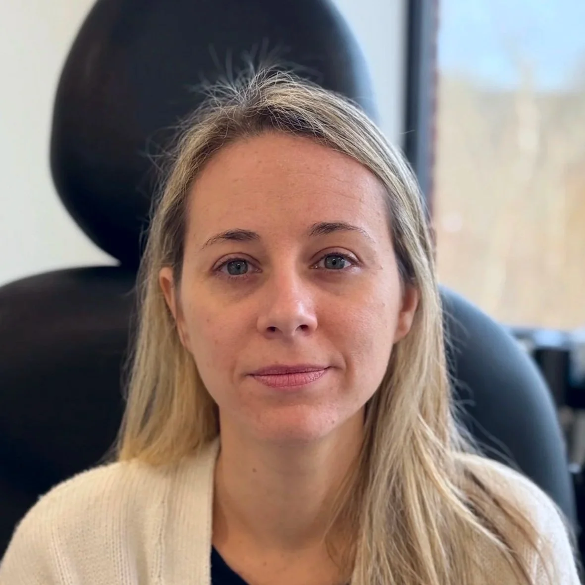 Female client before Neurotoxin treatment at Morph Med Spa in Ridgefield, CT – visible forehead, brow, and eye-area expression lines