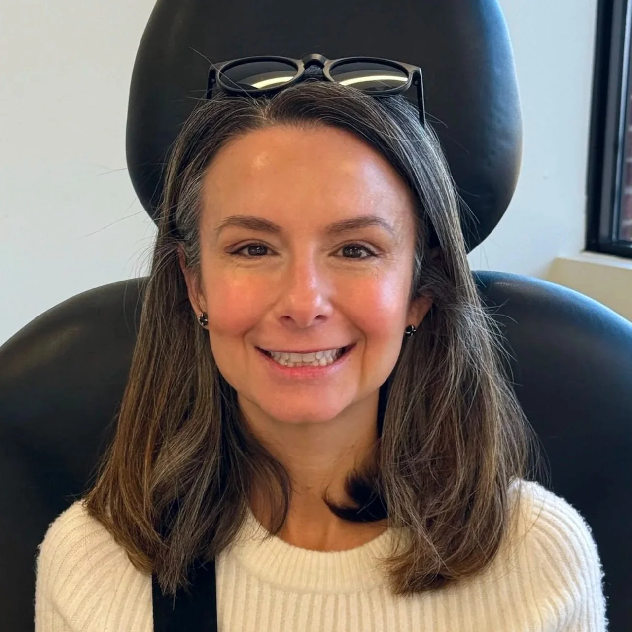 Female client after Neurotoxin treatment at Morph Med Spa in Ridgefield, CT — smoother forehead and softened crow's feet area