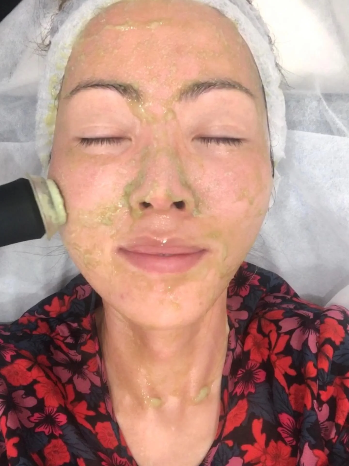 Could Australia&rsquo;s cosmetic advertising regulations have unintentionally encouraged more people to seek treatment overseas? What are your thoughts?

In recent years, stricter guidelines in Australia have limited the types of before-and-after pho