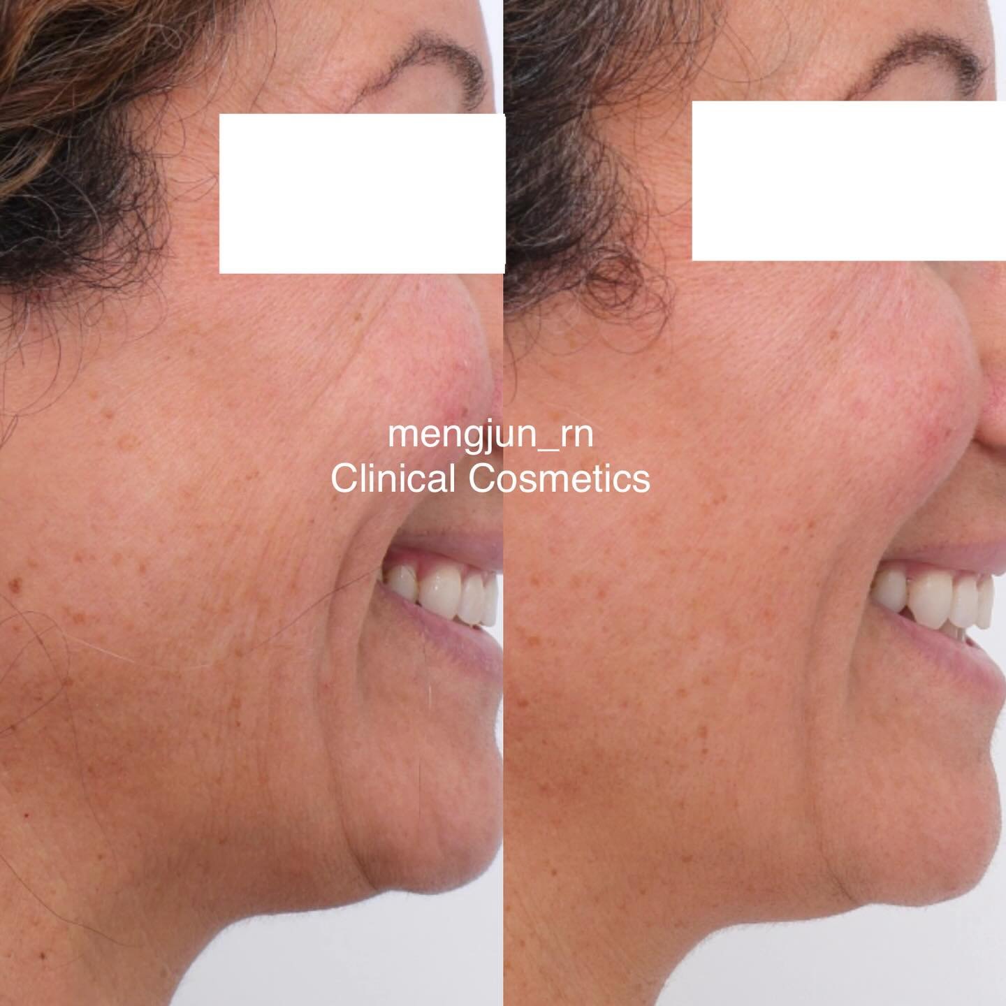 What do we actually mean by bio-regenerative treatments?

We&rsquo;re often asked what&rsquo;s &ldquo;most popular&rdquo; or what we love doing most. The honest answer is - it depends on you.

Our focus is always on choosing treatments that are likel