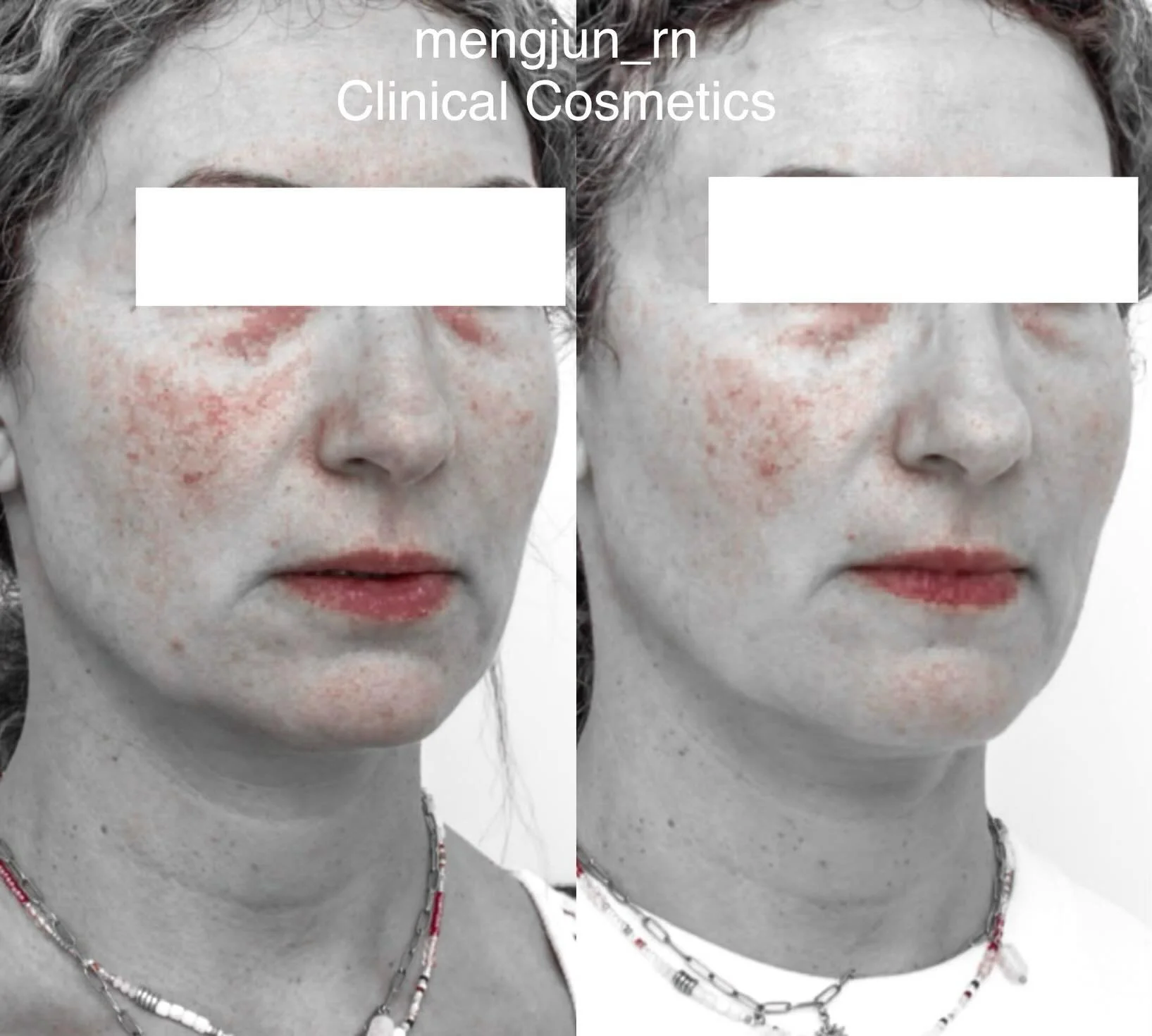 What if your skin changes could be measured - not just guessed?

At Clinical Cosmetics, we use advanced @clinicalimaging_systems to capture standardised photographs using the same lighting, angles, and skin analysis filters every time. This allows us