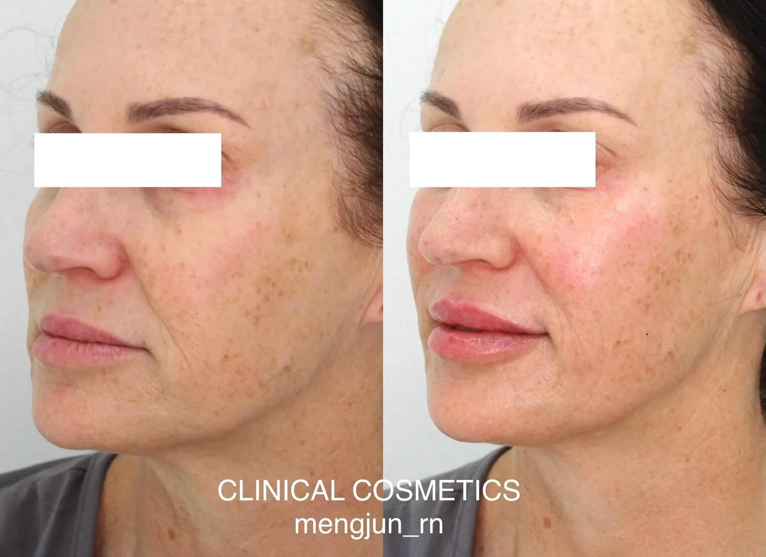 Many of our new clients come to us after doing their research - reading reviews, exploring our website, and looking for high-quality care with natural, consistent results they can feel confident in.

Some have tried treatments elsewhere before, but a