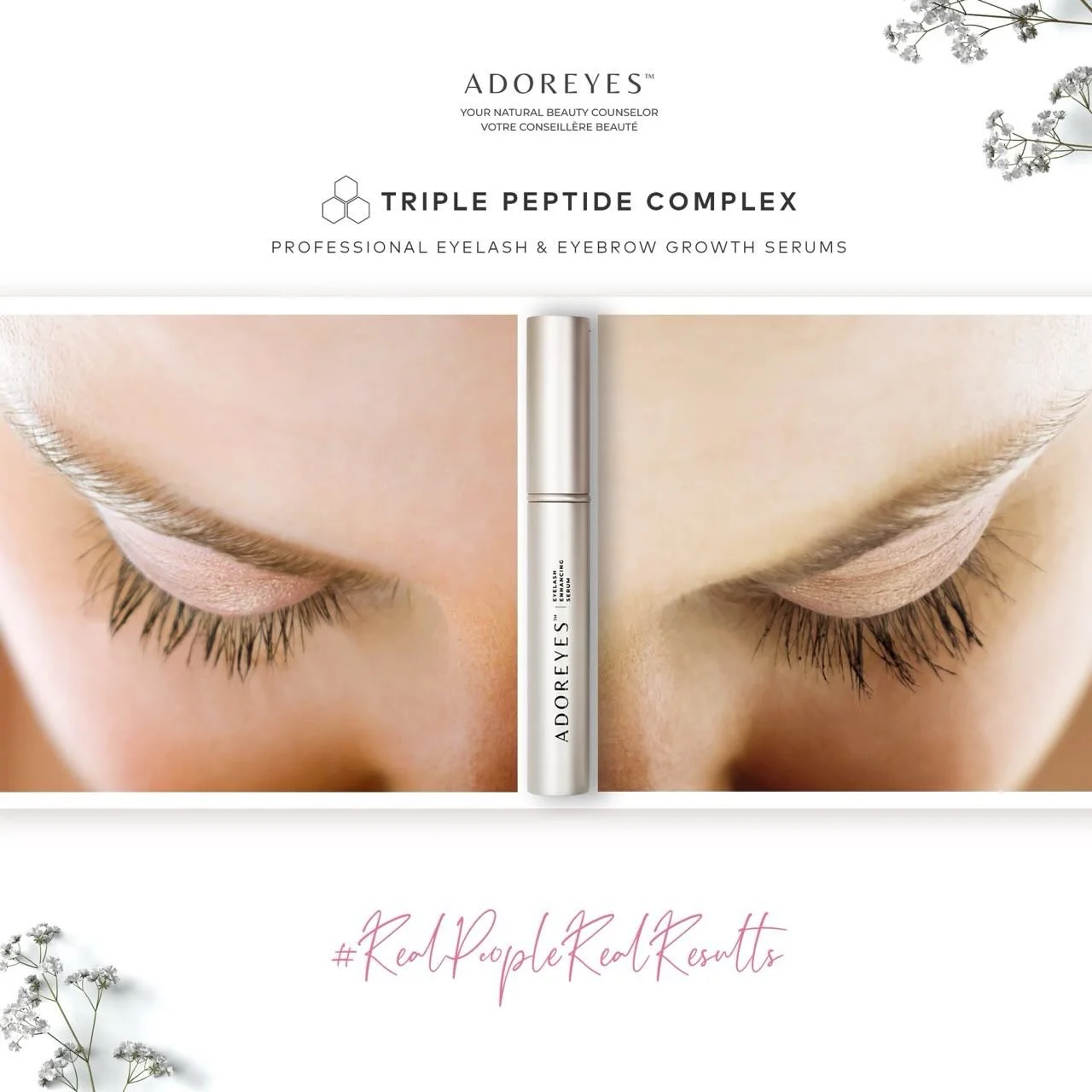Do faster lash serum results mean a better product? 

Not always.

Many lash serums that promise very rapid results contain prostaglandin analogues or prostaglandin-like ingredients. While these ingredients can be effective for lash growth, they have