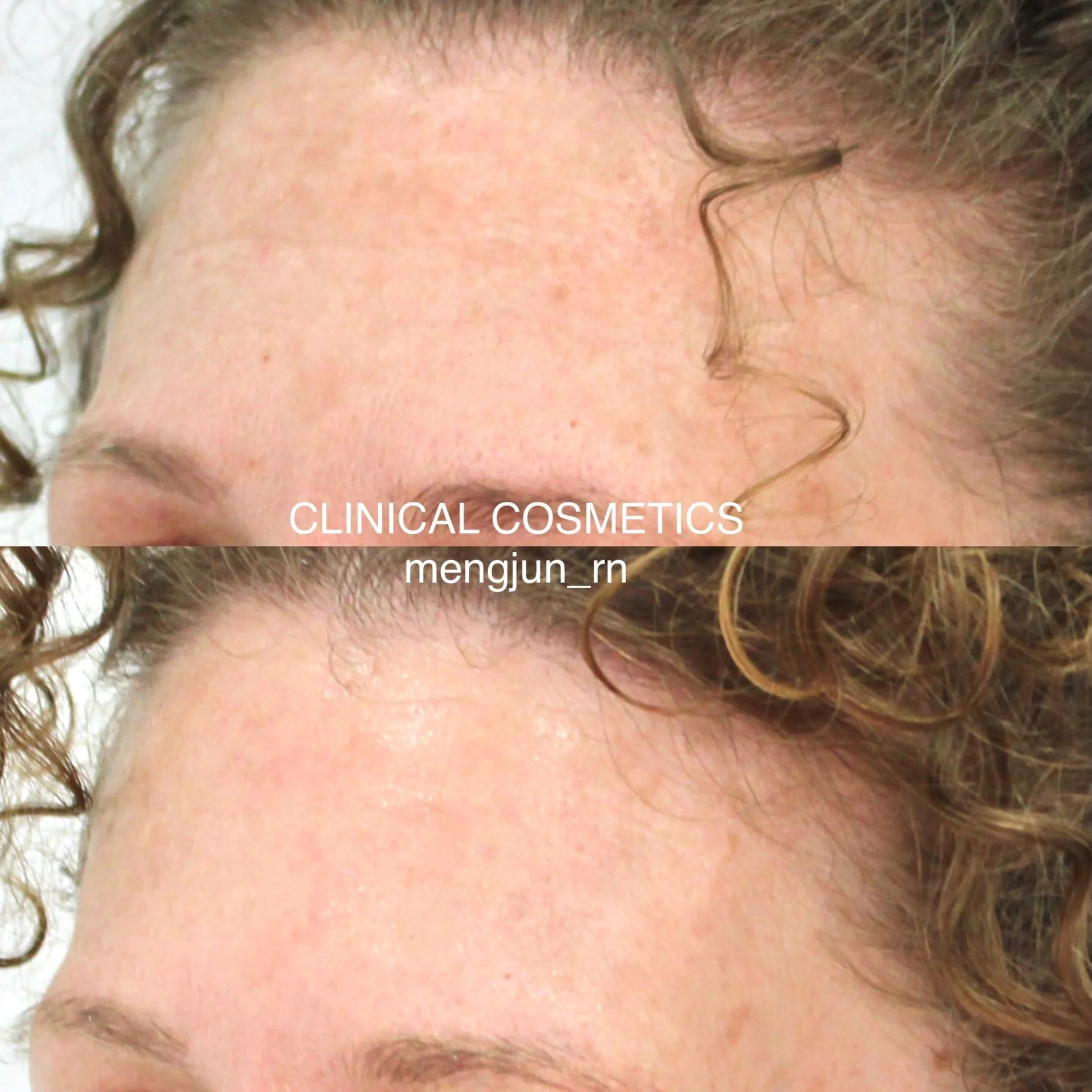 **What are Bio-Regenerative Treatments?**

A question we hear all the time!

Bio-regenerative treatments work differently from traditional cosmetic treatments. Rather than simply adding volume or relaxing muscles, they support your skin&rsquo;s own n