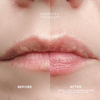 2_ADOREYES LIP SERUM BEFORE AFTER 3.png