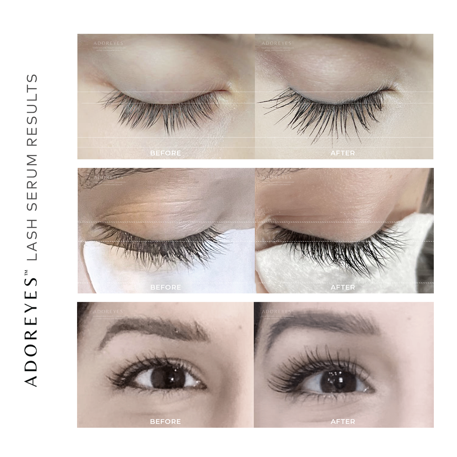 2A_ADOREYES_RESULTS_BEFORE_AFTER_1 copy.png