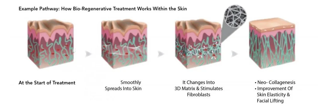 Diagram illustrating bio-regenerative skin treatment process, showing skin layers, collagen transformation into 3D matrix, and resulting skin improvement.