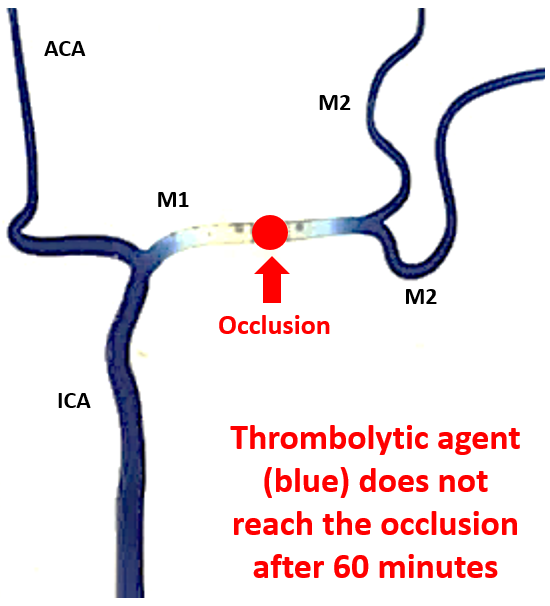 _The Solution_ TheraLode page left side.PNG
