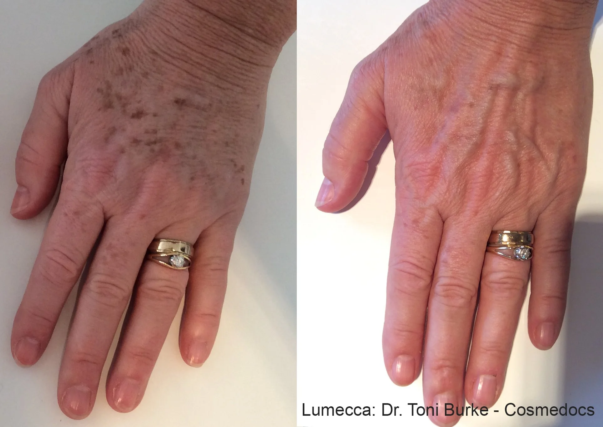 TB_Lumecca_1a_Hands.jpg