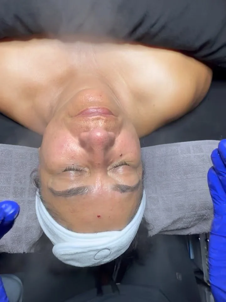 ✨ Clarify + Glow Facial Transformation ✨

Today&rsquo;s treatment featured a customized Clarify Facial using the powerful, science-backed ZO&reg; Skin Health line.
We started with a gentle dermaplane to sweep away dead skin and peach fuzz, followed b