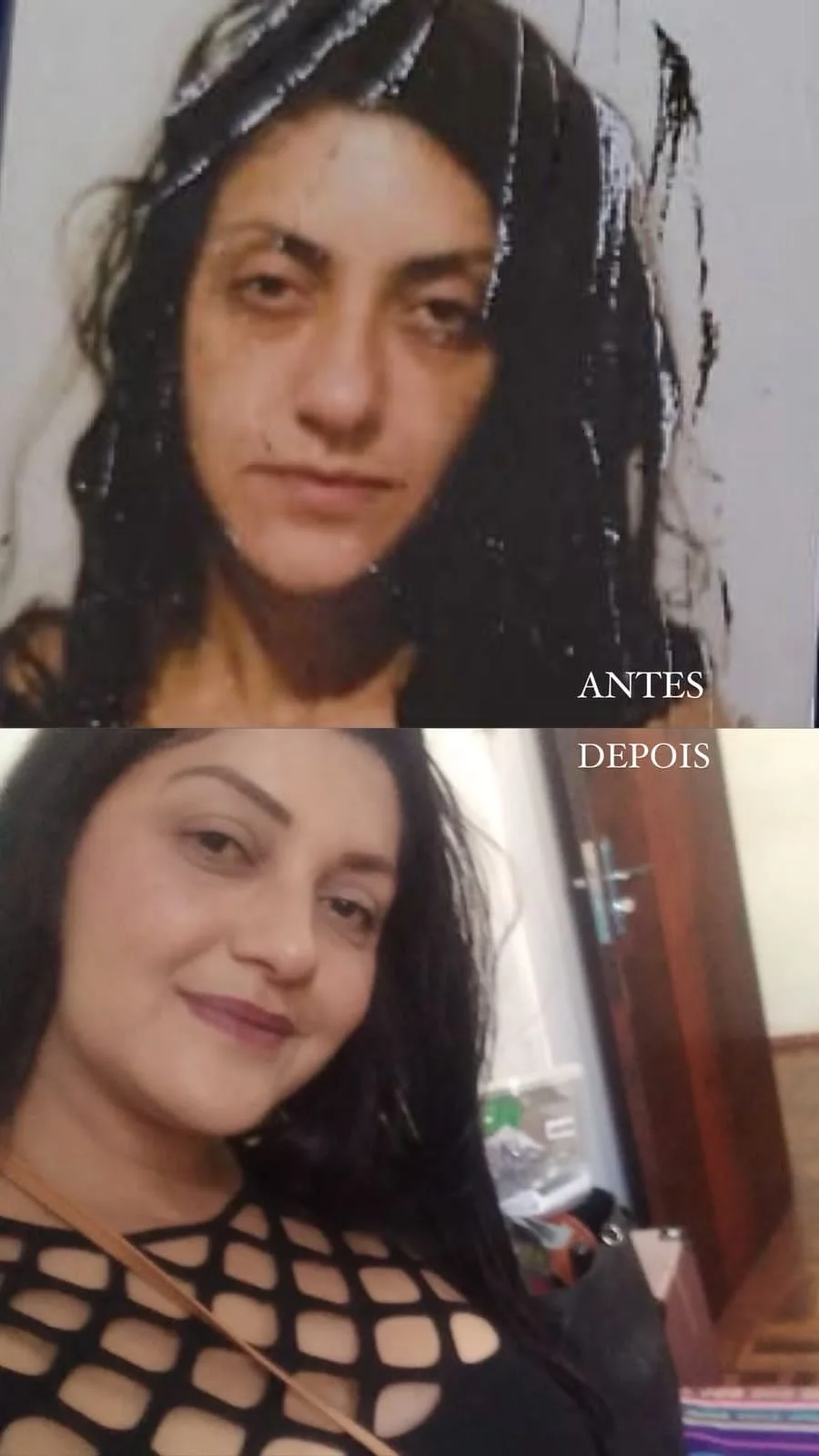 Fotos de antes e depois de uma mulher / before and after photos of a woman / fotos de antes y después de una mujer