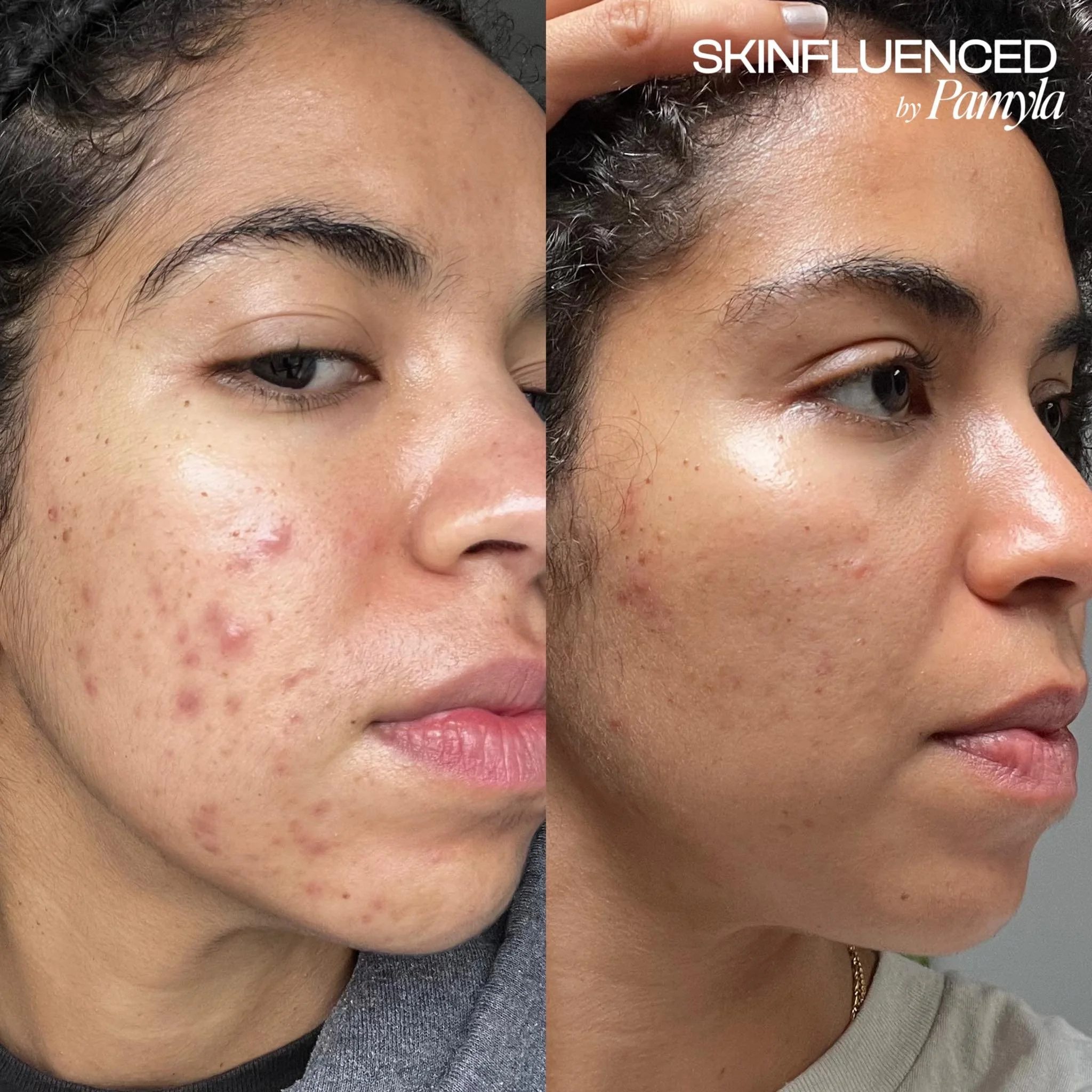 mariam’s experience