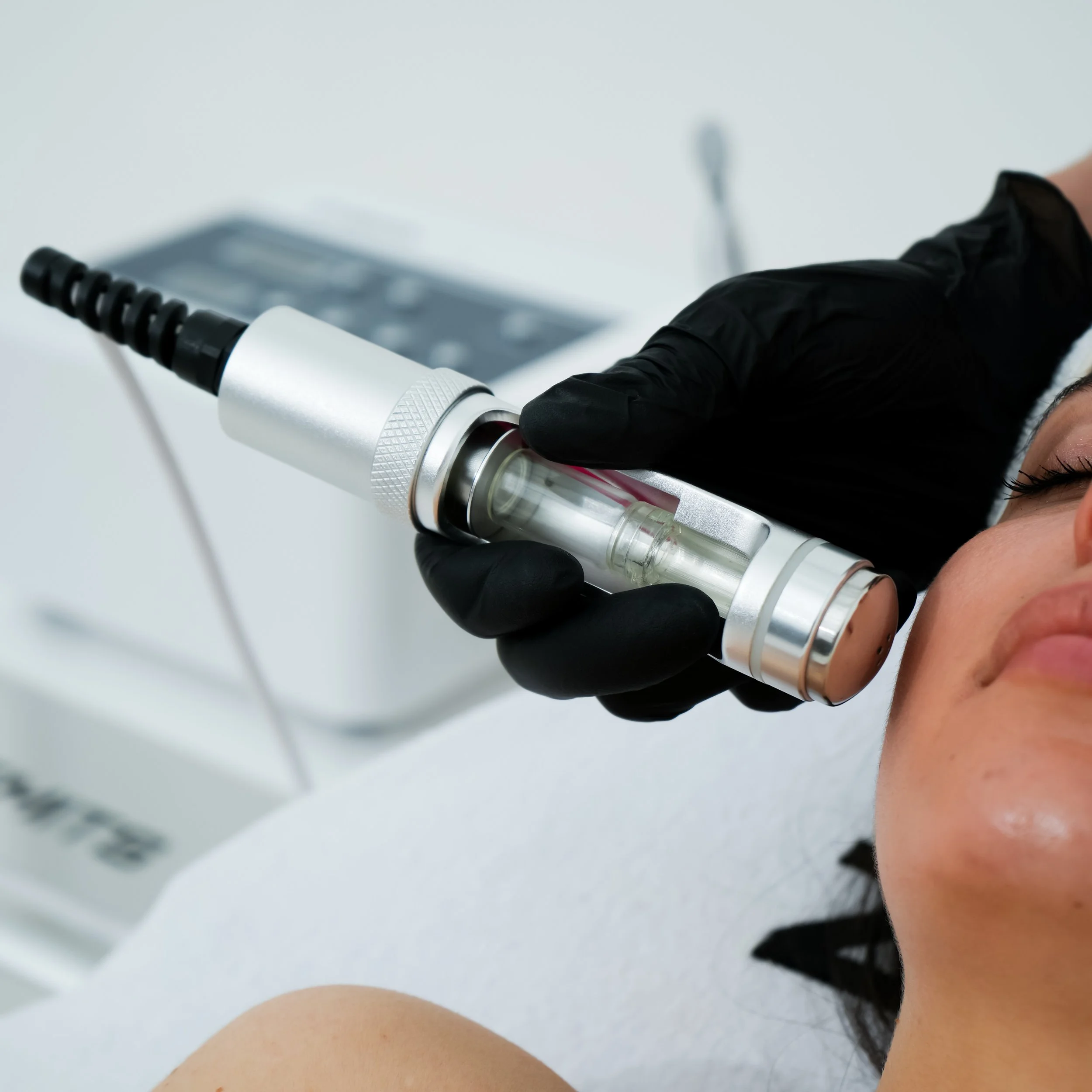 EXOSOME-BASED THERAPY