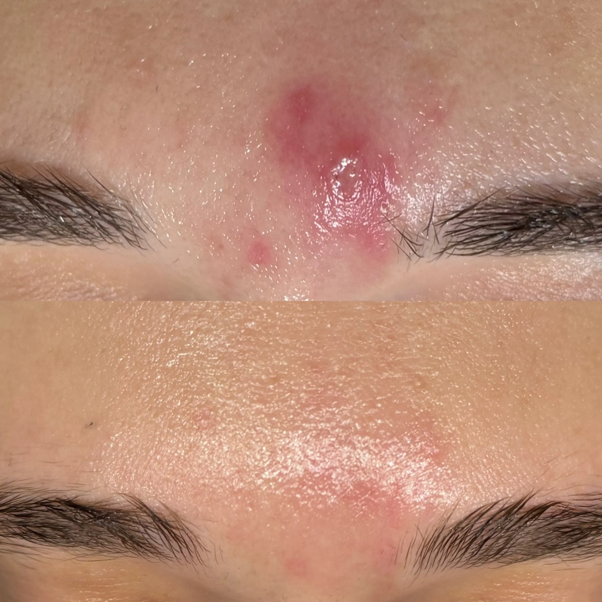 marissa shandell forehead full recovery after gsp.jpeg