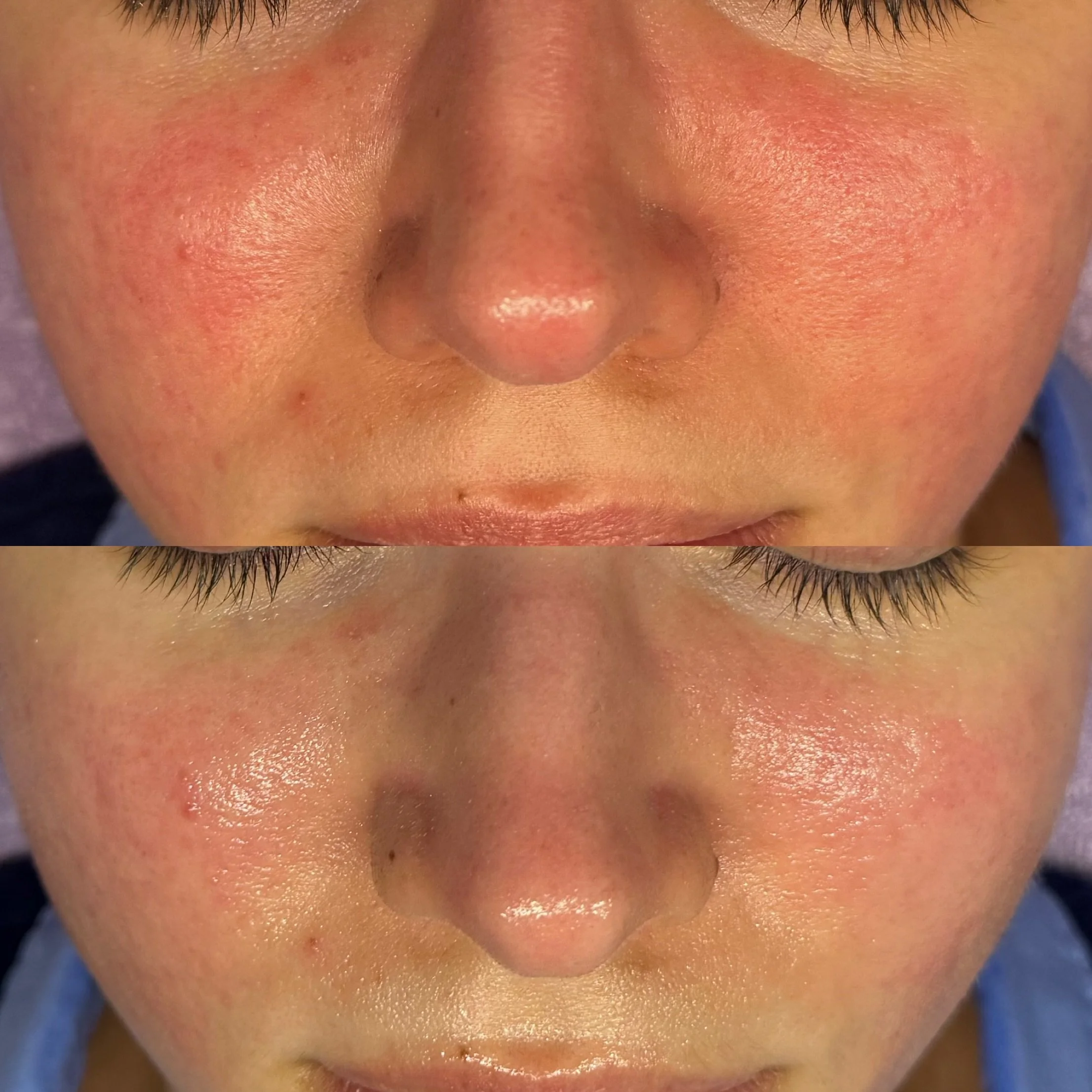 gab stan same day 2026 redness.jpeg