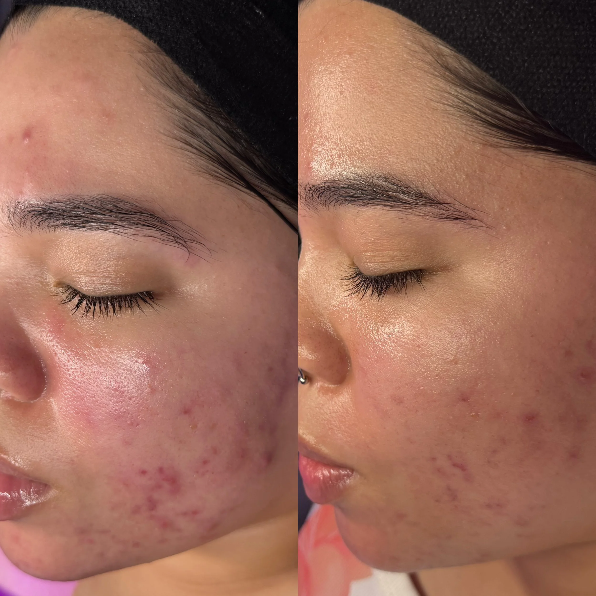 sally pimentel 2 weeks profile.jpeg