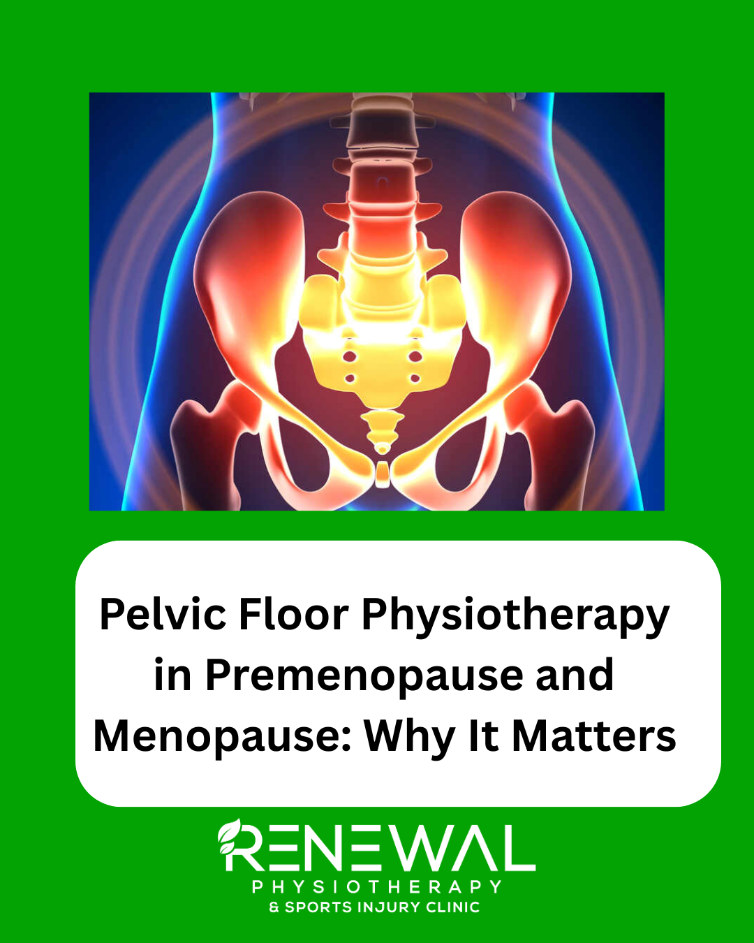 Pelvic Floor Physiotherapy in Premenopause and Menopause: Why It Matters
