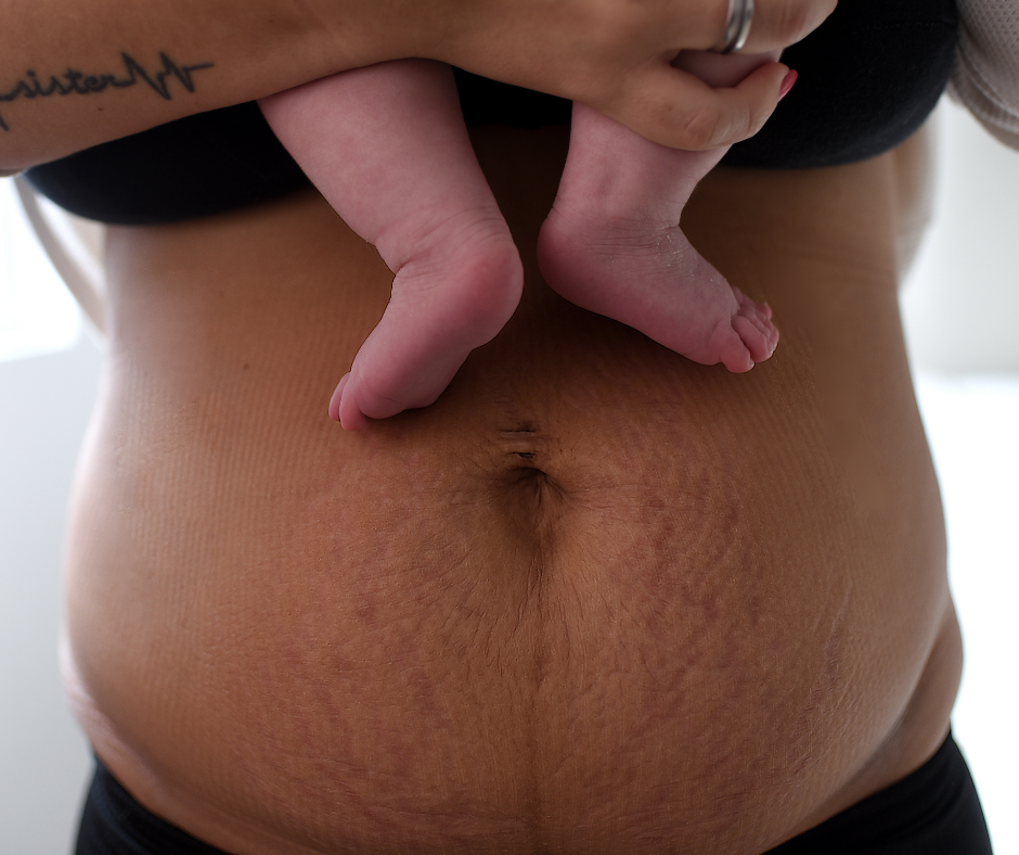 Postpartum belly with baby