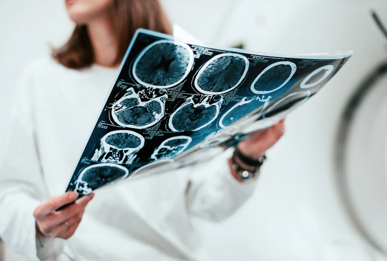 Arztin überprüft medizinische Bildaufnahmen, vermutlich CT- oder MRT-Scans des Gehirns.