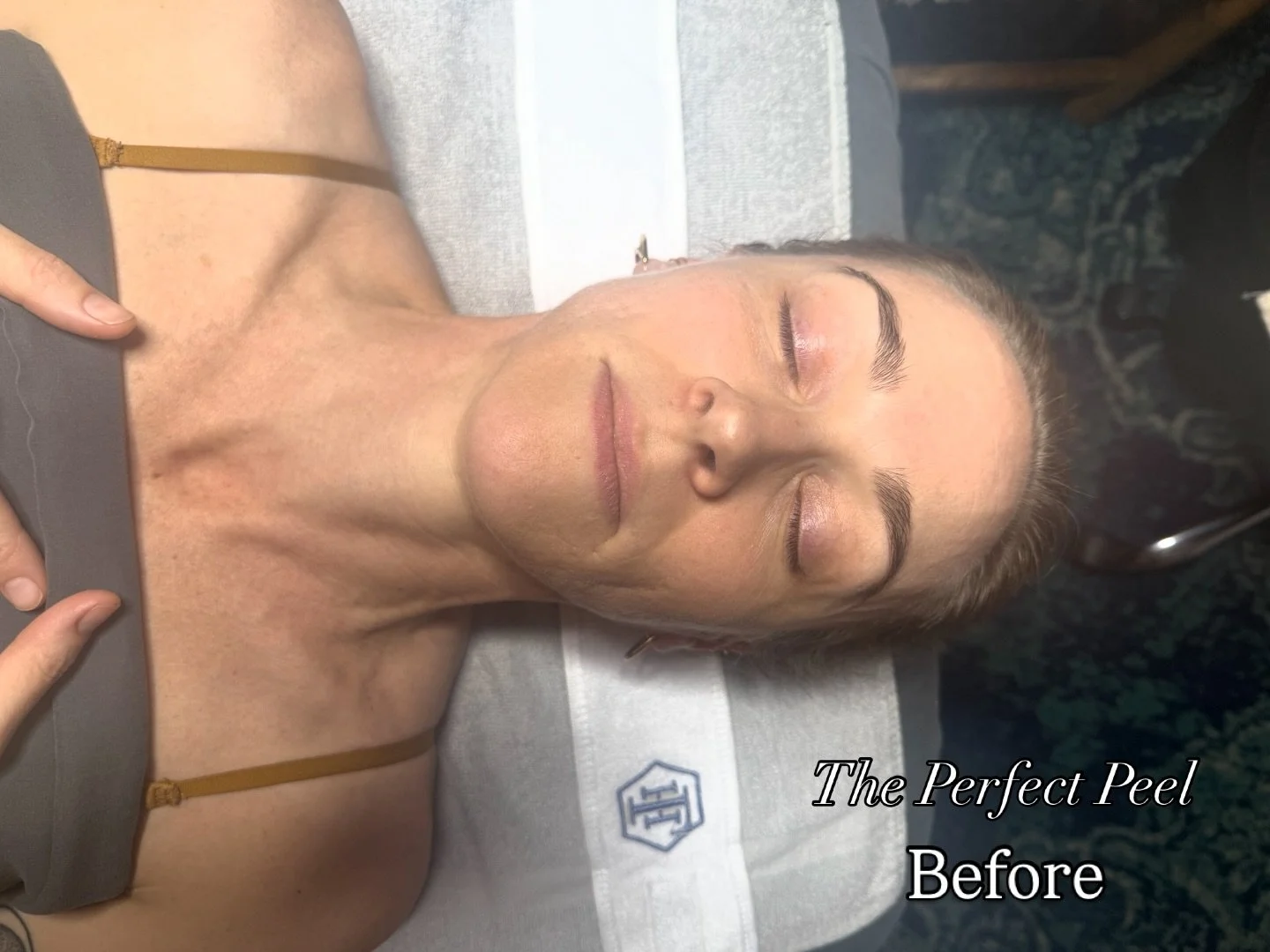 Is there anything better than an instant glow? 🤩 we think not! 

Meet our newest skin treatment: ✨ The Perfect Peel ✨
A brightening, tightening, no-downtime peel designed to leave your skin visibly smoother, clearer, and glowing after just one sessi