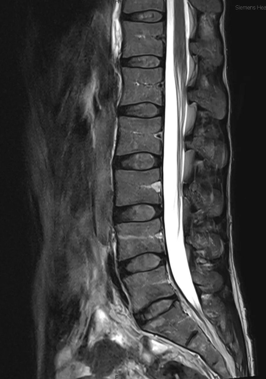 MRI - lumbar.jpeg