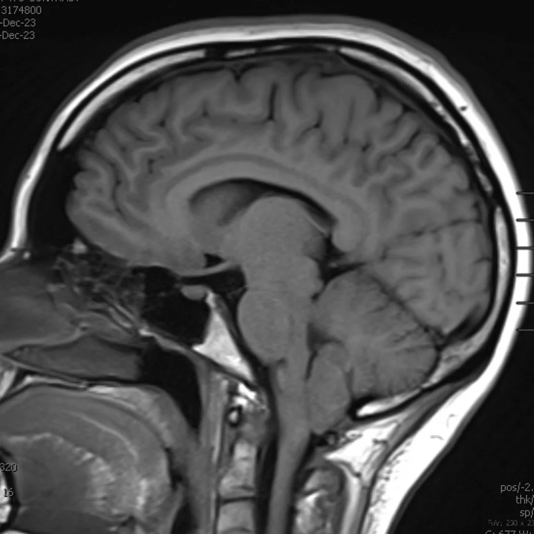 Brain MRI.jpg