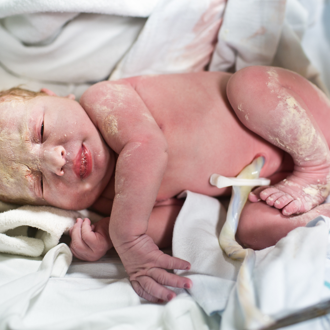 What is delayed cord clamping?