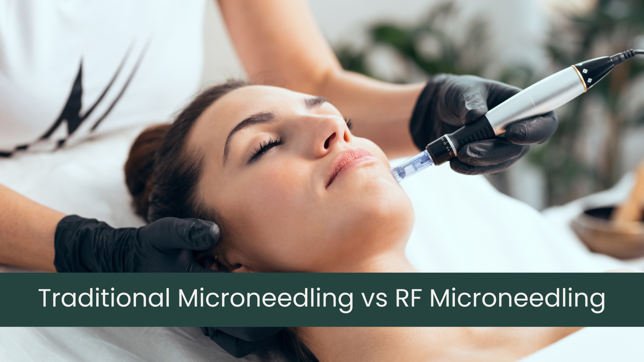 Microneedling vs RF Microneedling