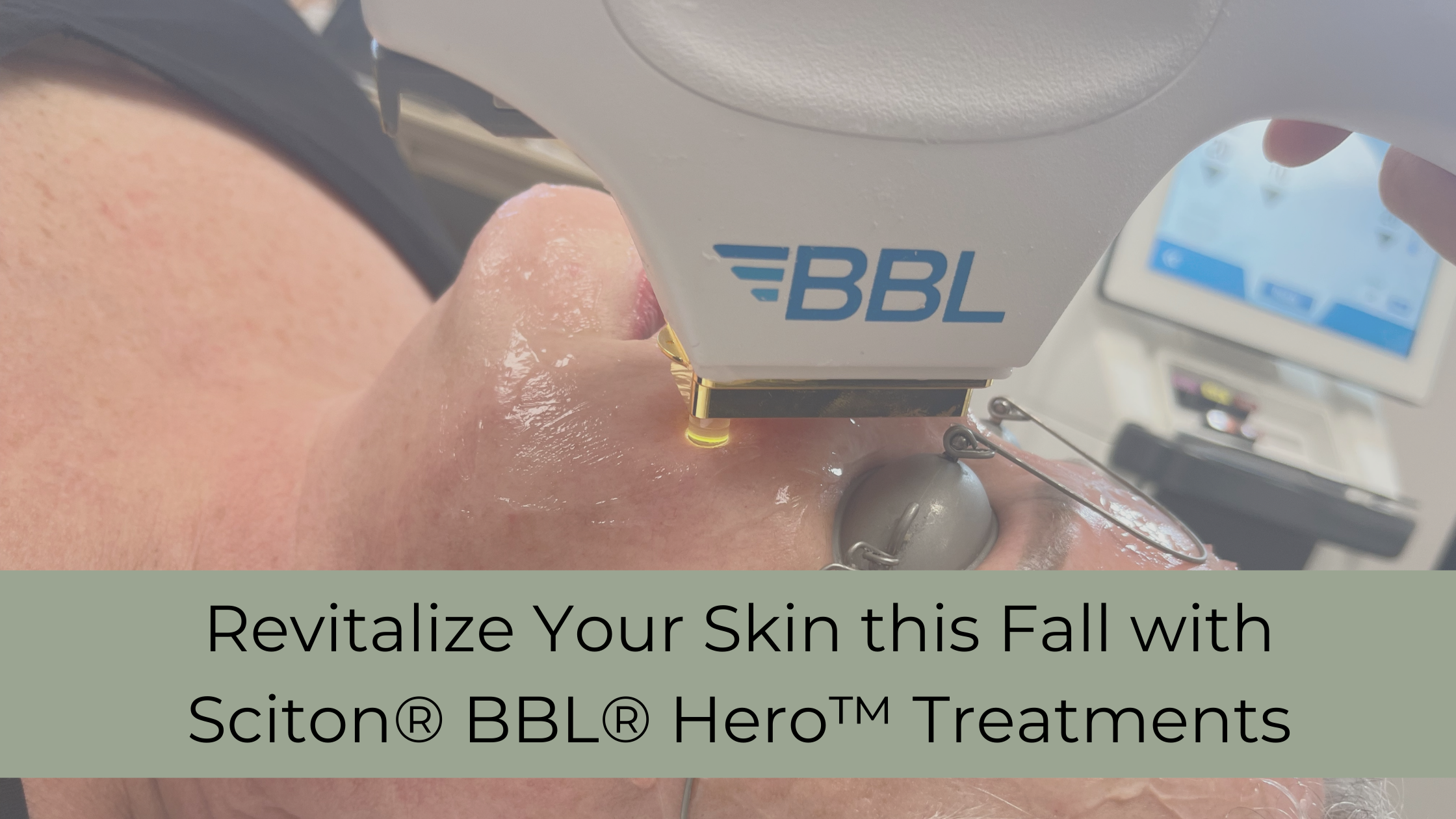Revitalize Your Skin this Fall with Sciton® BBL® Hero™ Treatments