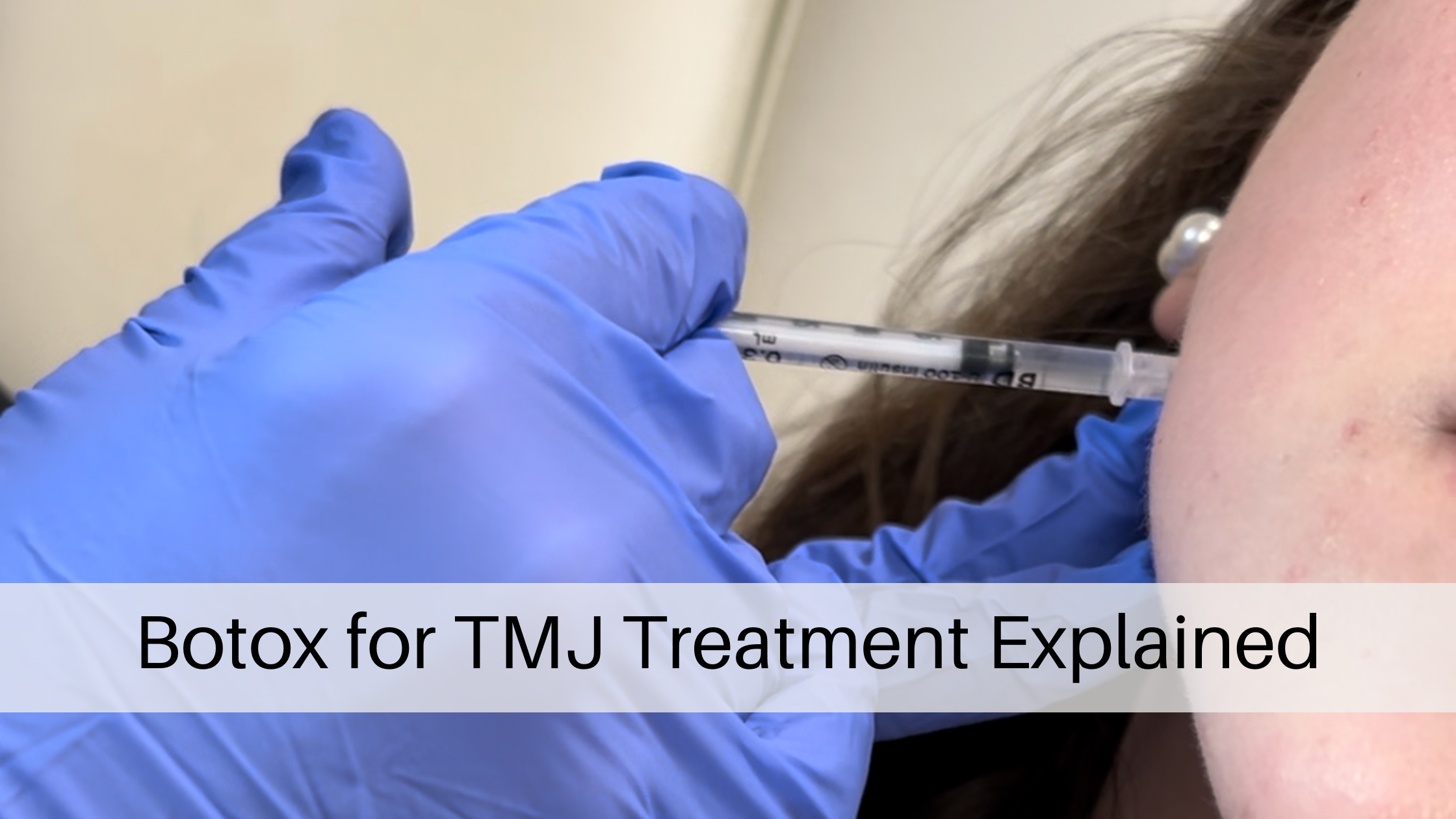 Botox for TMJ Treatment Explained