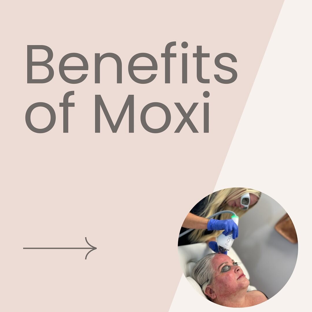 Moxi is a favorite among treatments offered at Wellness Revolution! There are so many reasons to love it, but here are a few!