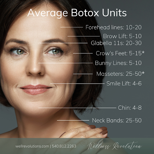 How Many Units of Botox® Do I Need? — Wellness Revolution