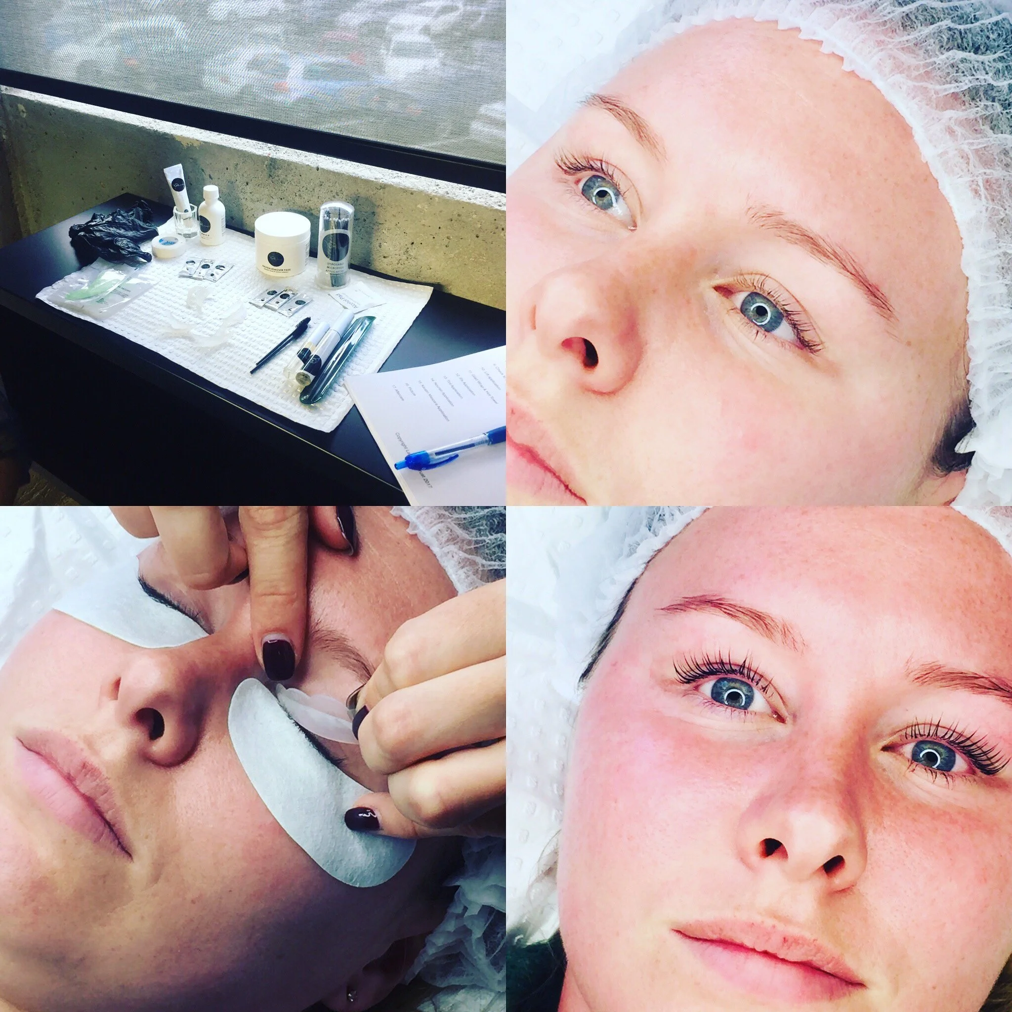 A person lying down, wearing black underwear, receiving a cavi-lipo cellulite & fat cell reduction on the abdomen frontally.