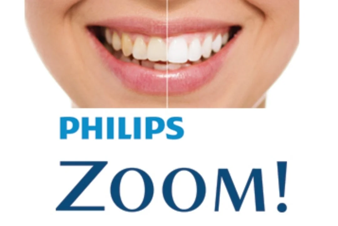 Teeth Whitening Calgary, AB, Canada Teeth Whitening and Aesthetic