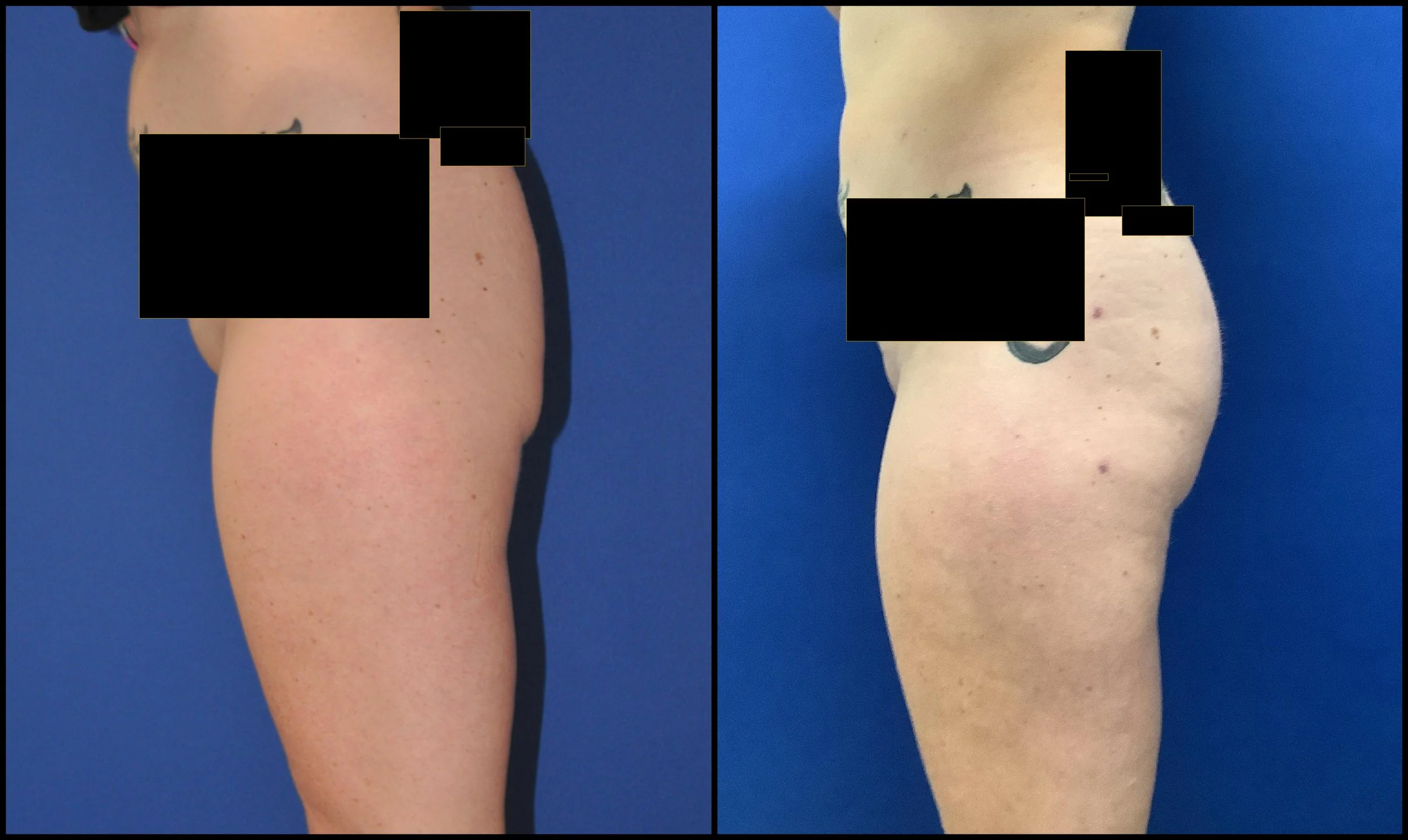 compare-05.27.2022-34289576.png