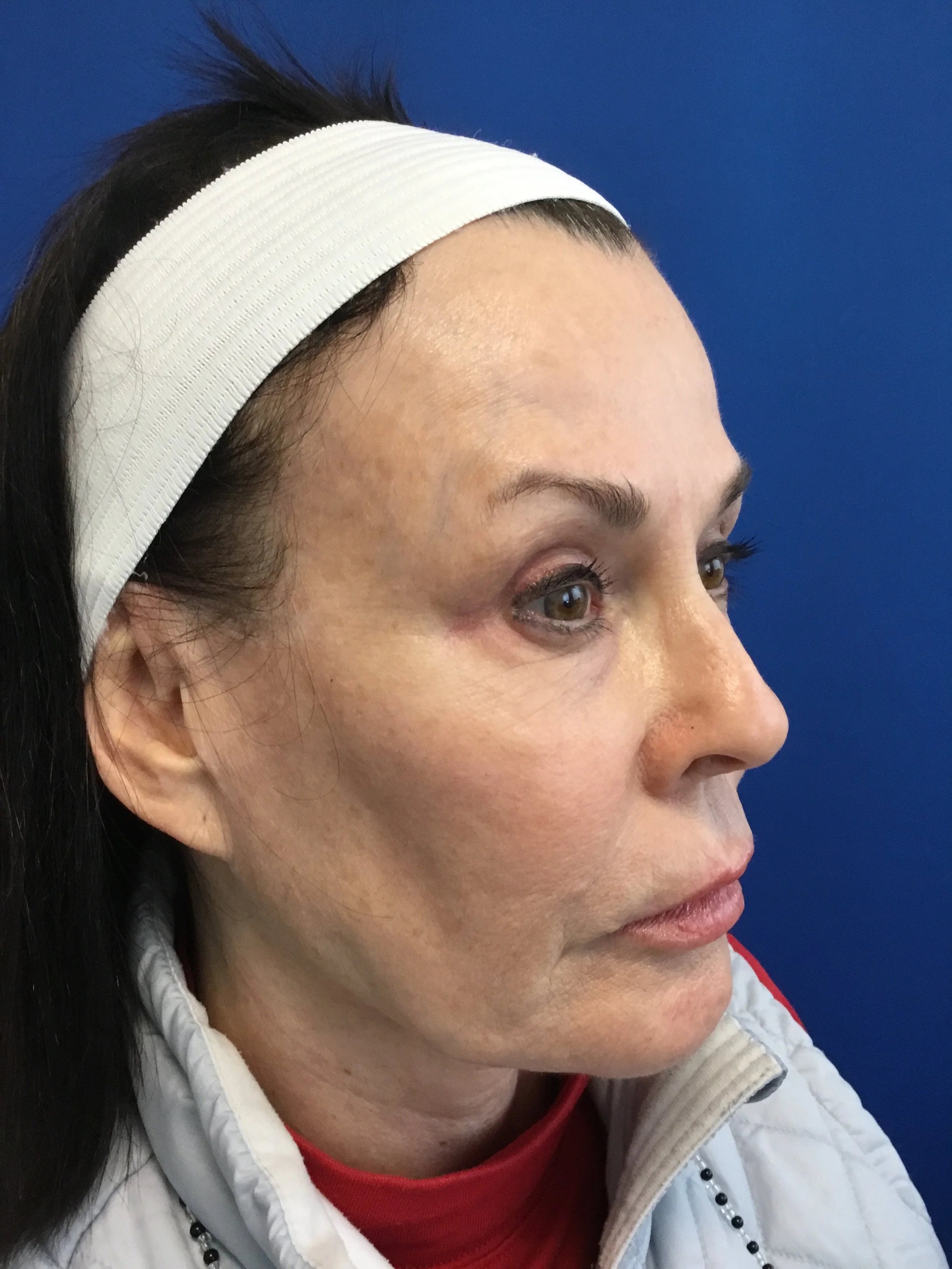 face-oblique-right-04.25.2022-32921113.jpg