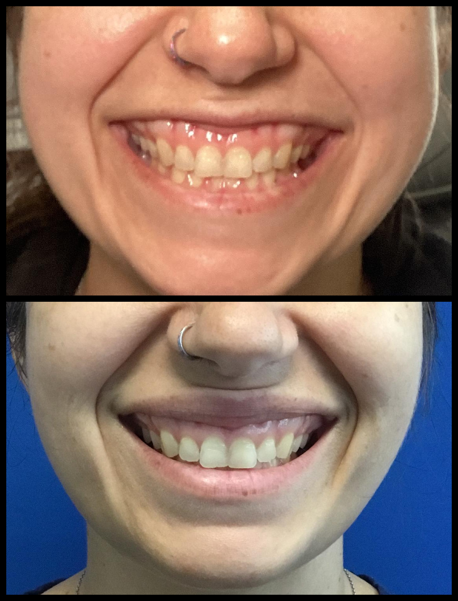 compare-06.06.2022-34584436 (1).png