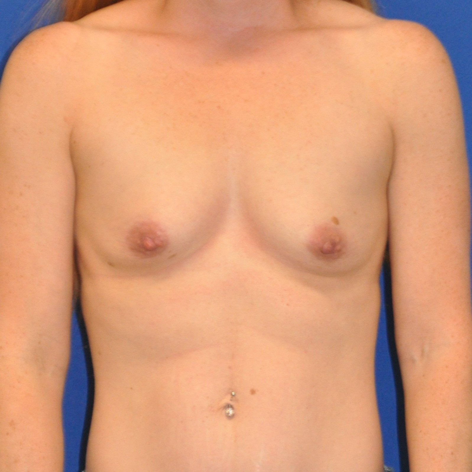 breast-anterior-01.05.2012-26529546.jpg