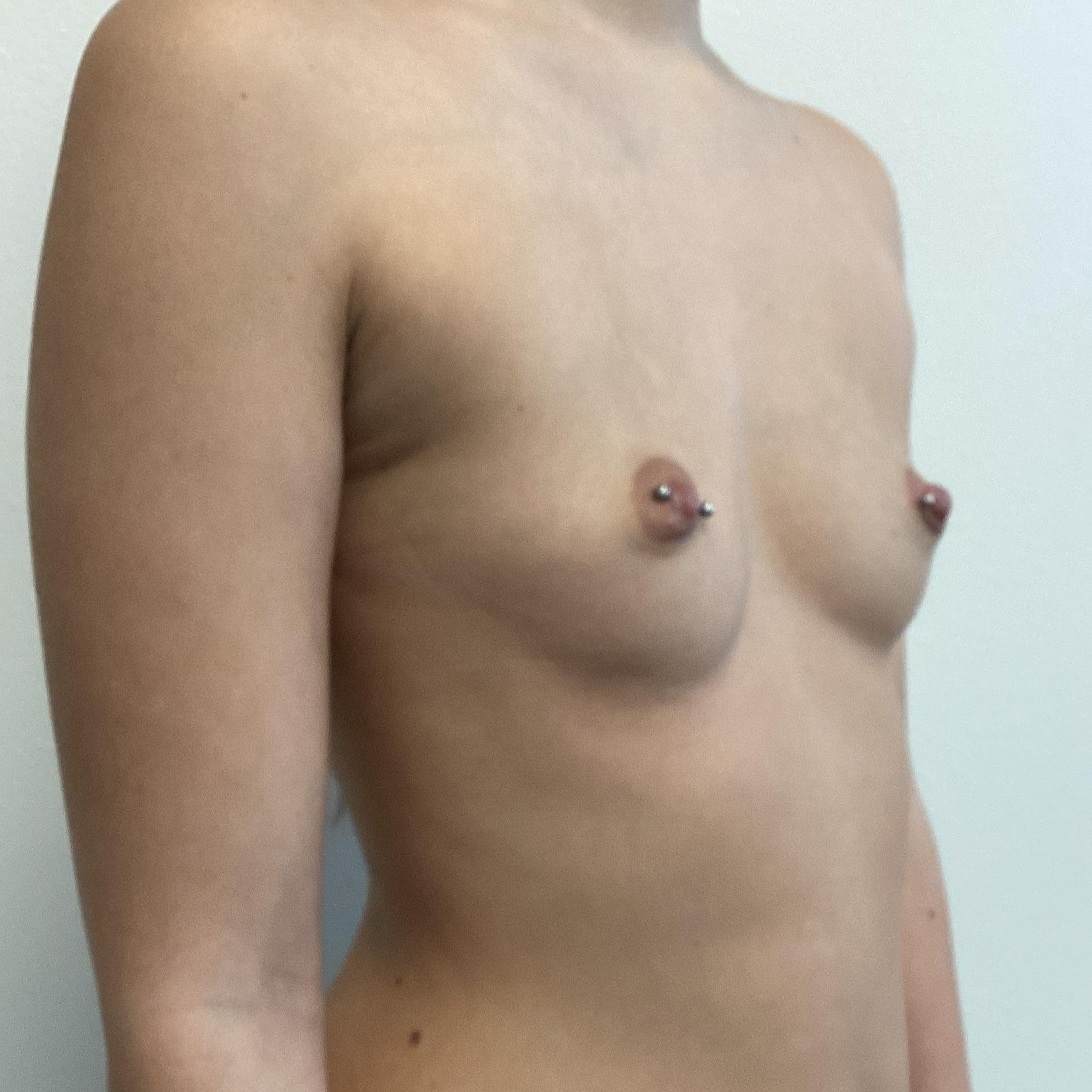 breast-anterior-oblique-right-01.21.2022-32489944.jpg