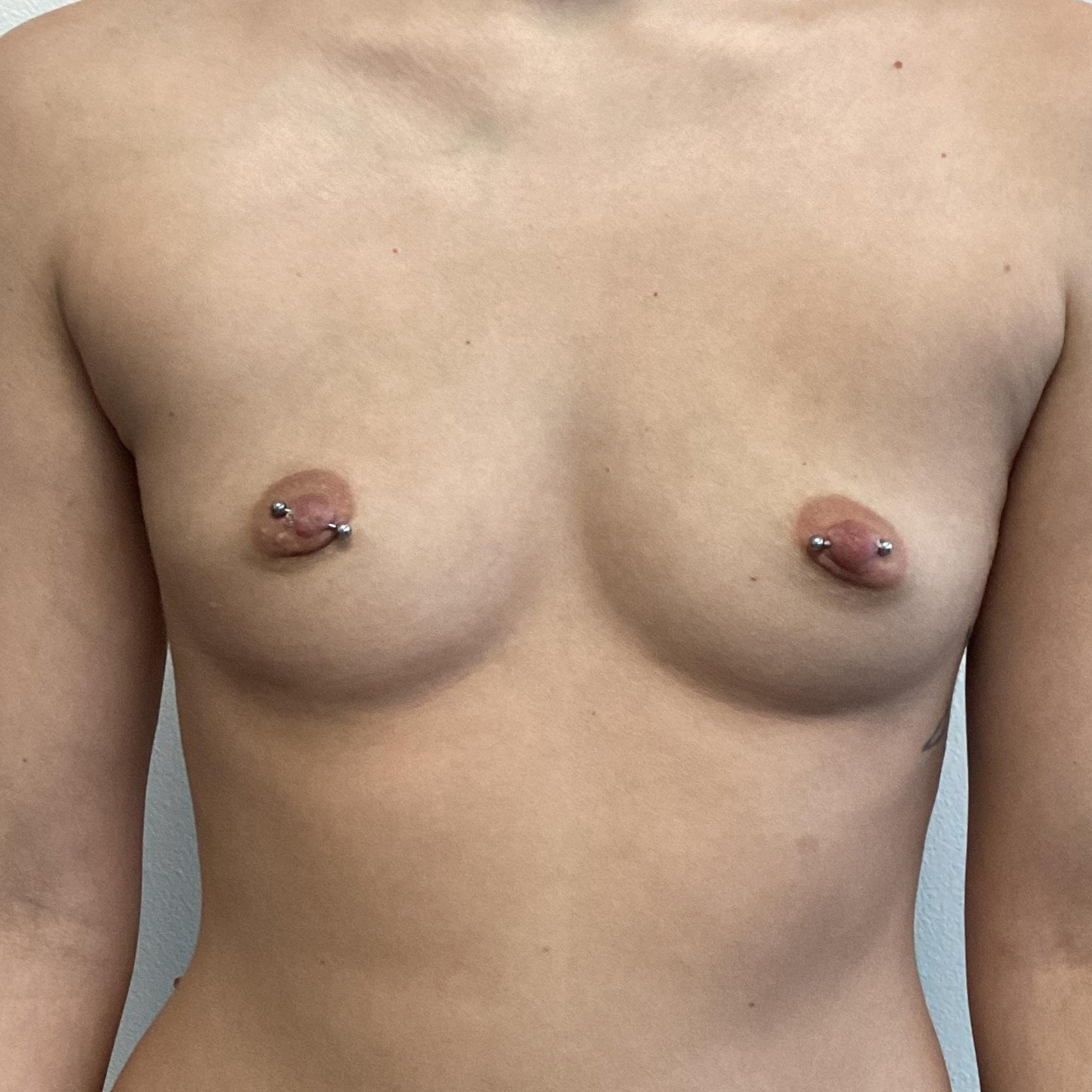 breast-anterior-01.21.2022-32490018.jpg
