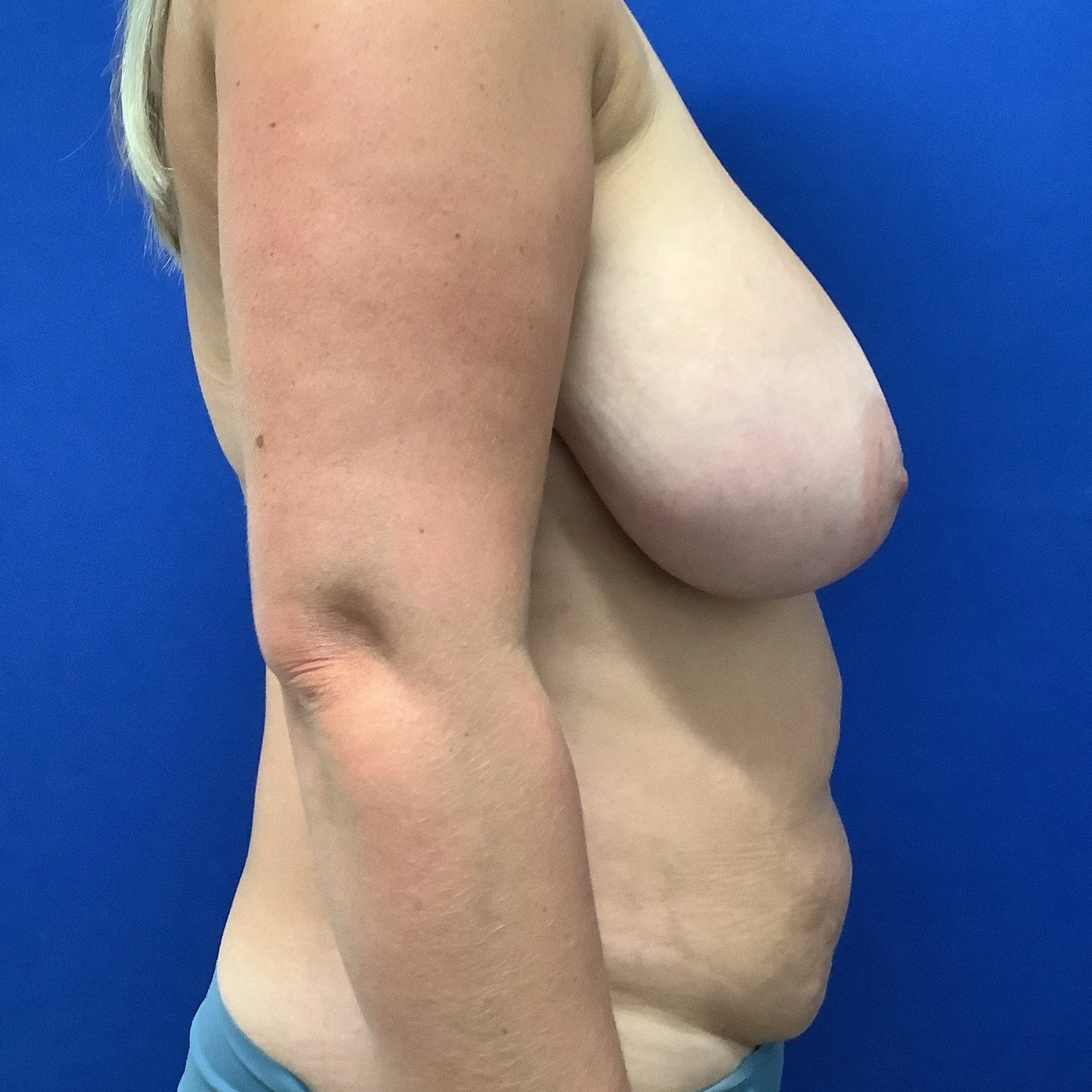 tram-posterior-oblique-left-09.16.2021-25244747.jpg