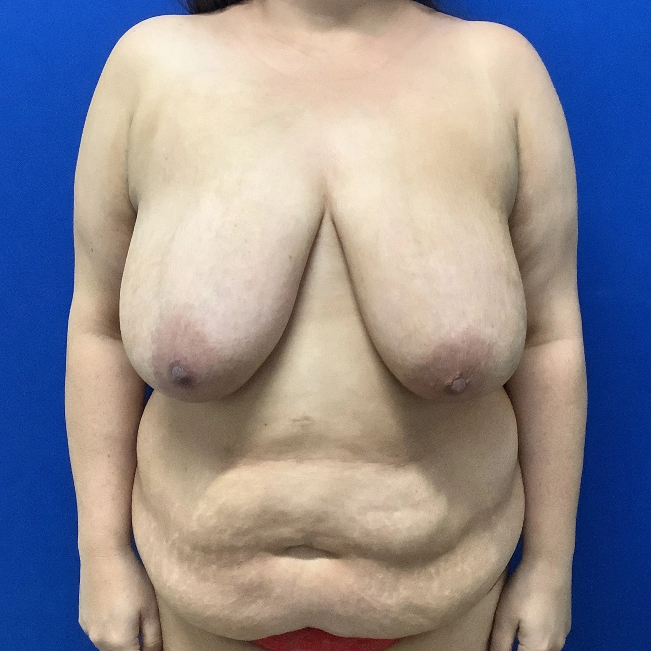 upper-body-anterior-08.26.2021-24637431.jpg