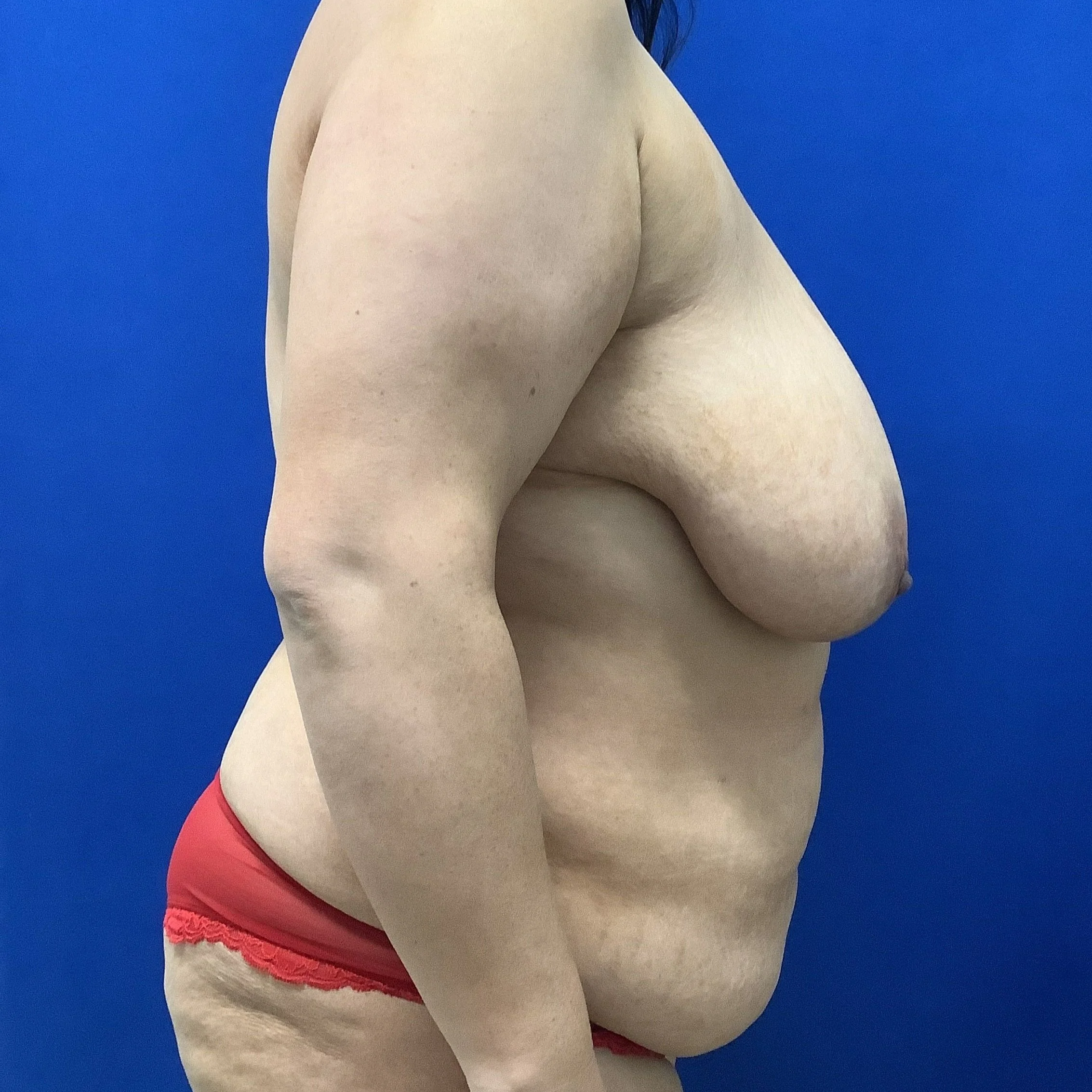 tram-posterior-oblique-right-08.26.2021-24637545.jpg