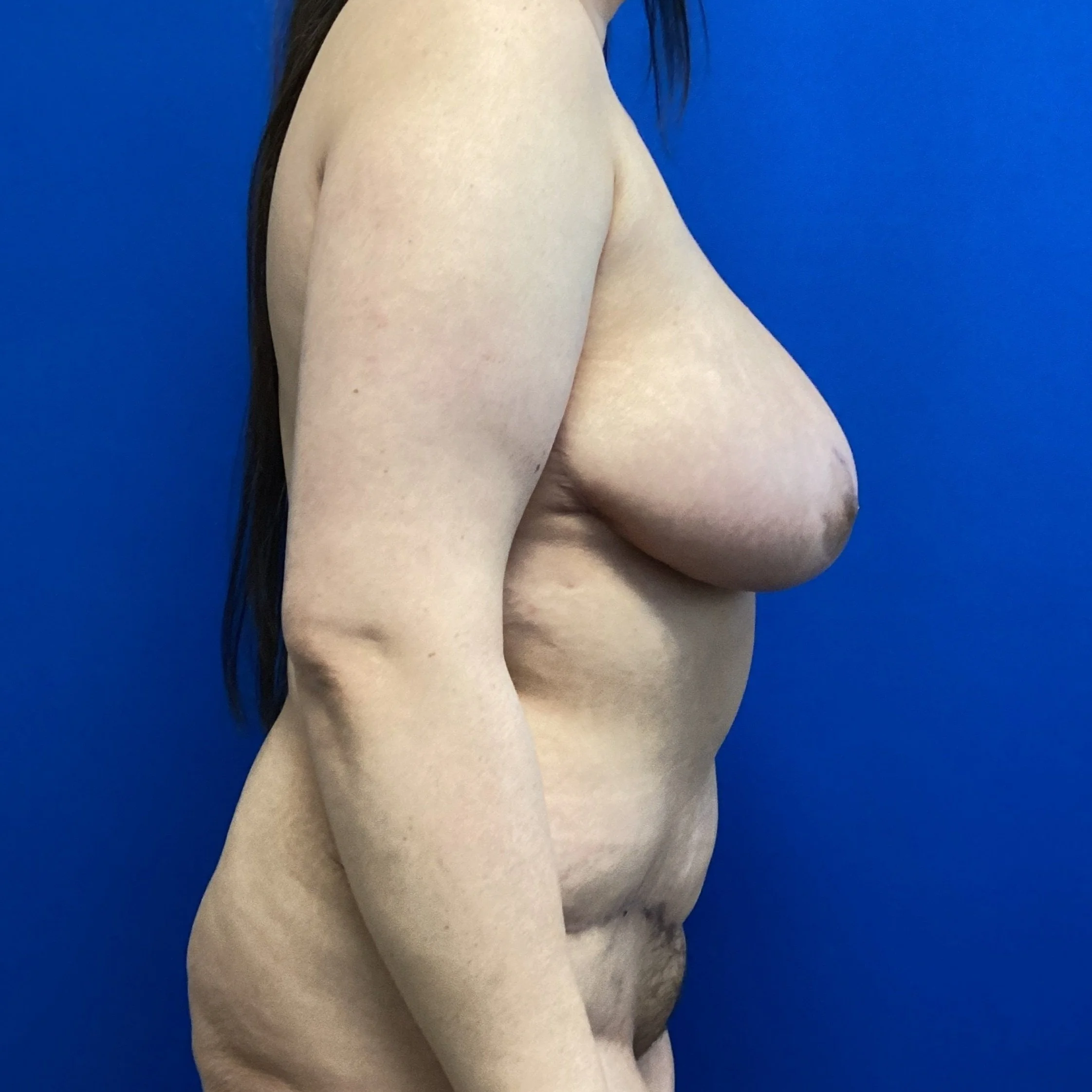 tram-posterior-oblique-right-02.11.2022-30046689.jpg