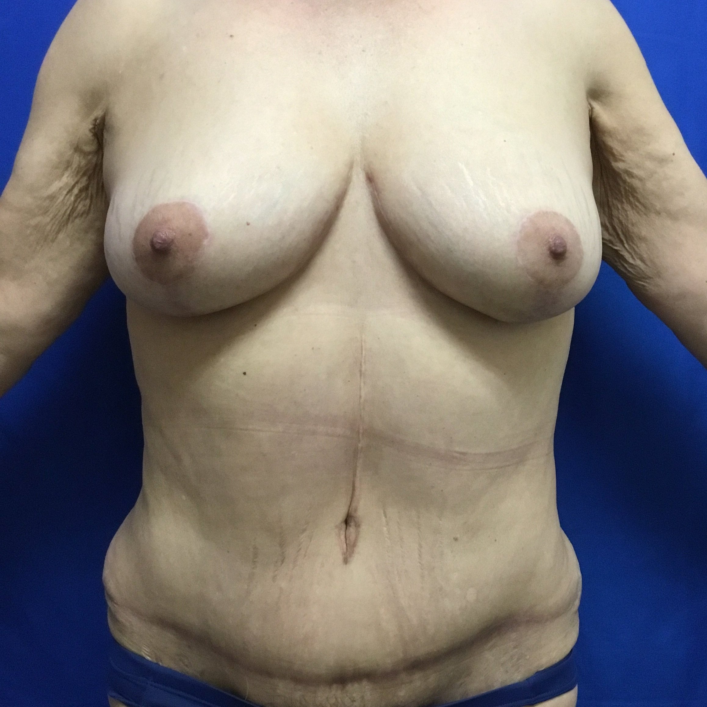 tram-anterior-09.29.2022-39236264.jpg