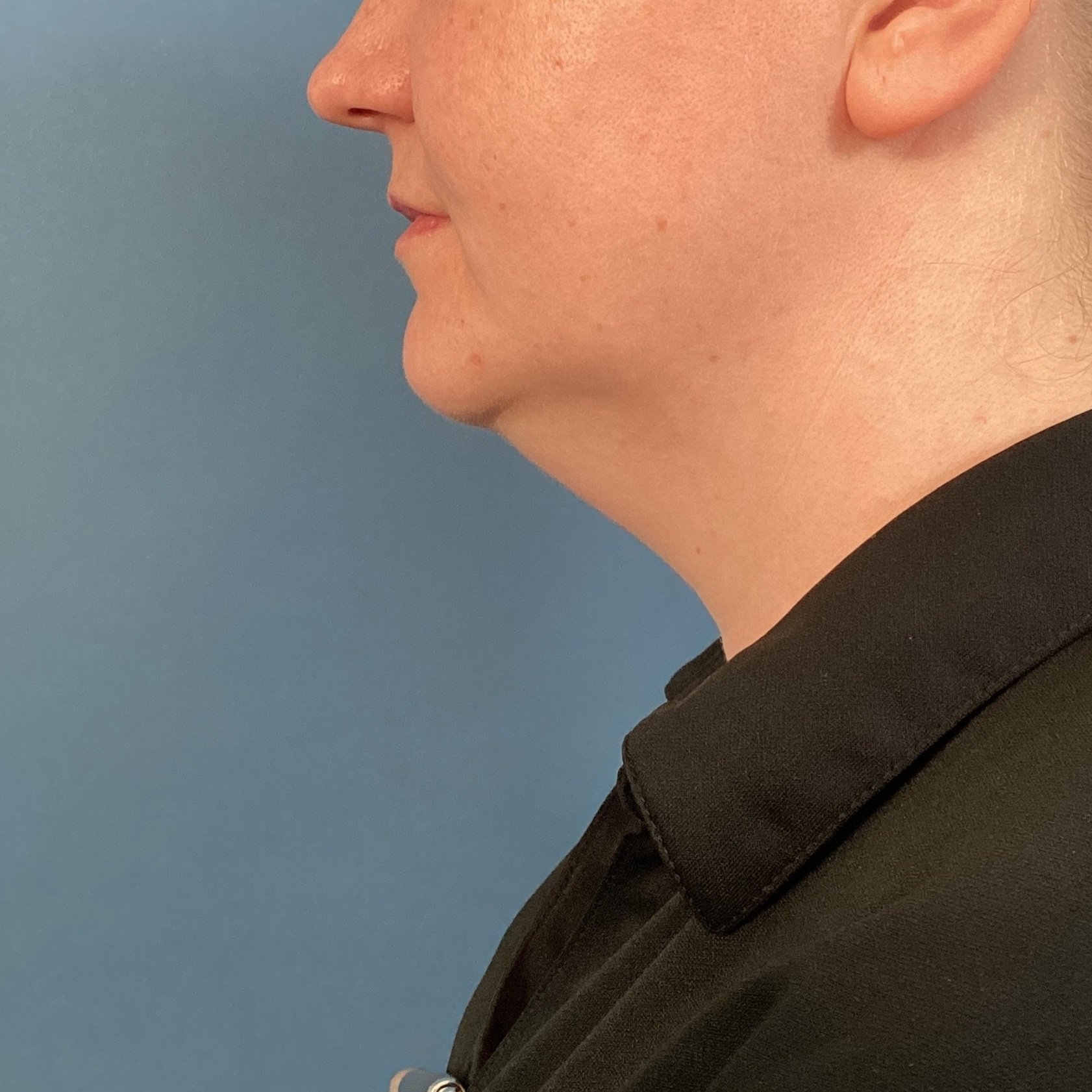 neck-landscape-lateral-left-07.16.2024-72656785.jpeg