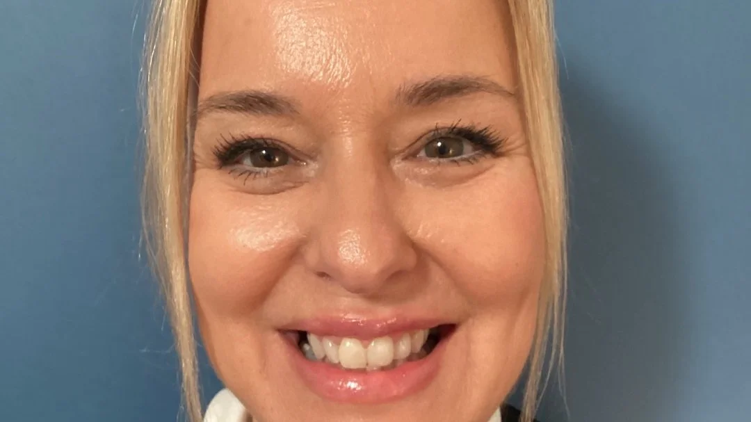 After an upper blepharoplasty, neck and jowl lipo with renuvion and lip filler