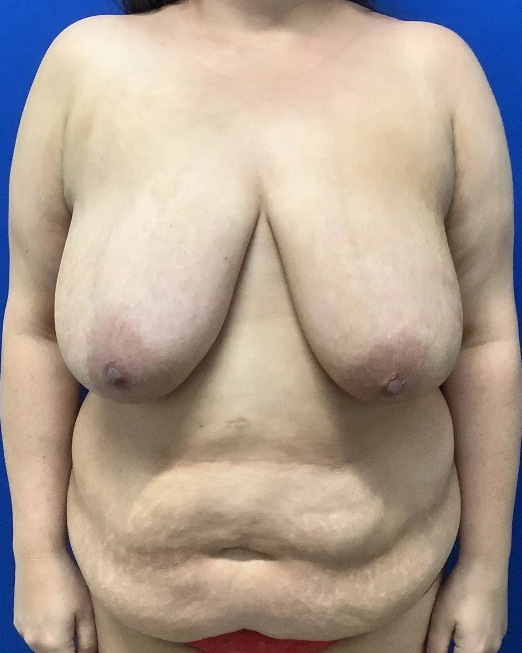 upper-body-anterior-08.26.2021-24637431.jpg